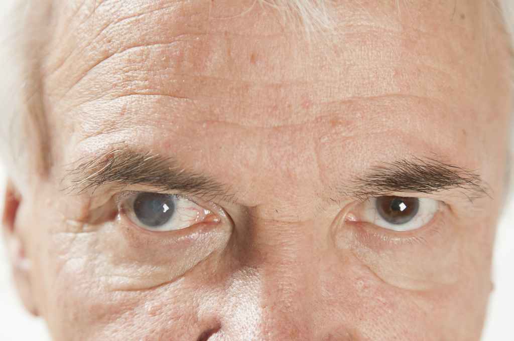 Kenali Lengkap Penyakit Mata Degenerasi Makula